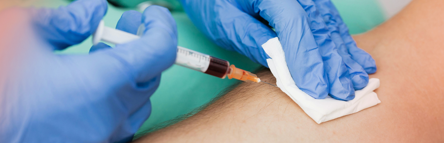 Irregular Periods Explained: What Blood Tests Reveal