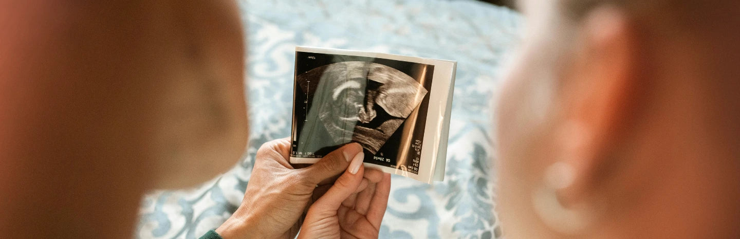 A person is holding an ultrasound image, showing a developing baby.