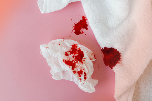 Are Period Blood Clots Normal? Here's What To Know